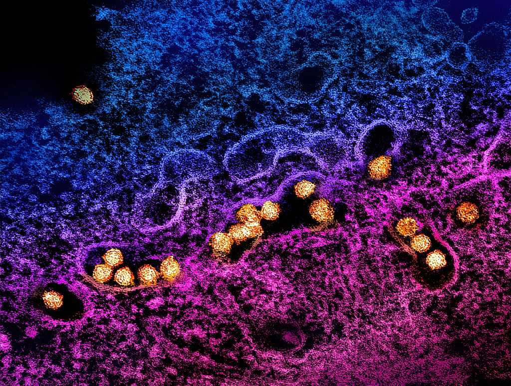 West Nile Virus Claims First Victim in Placer County: How Safe Are You?