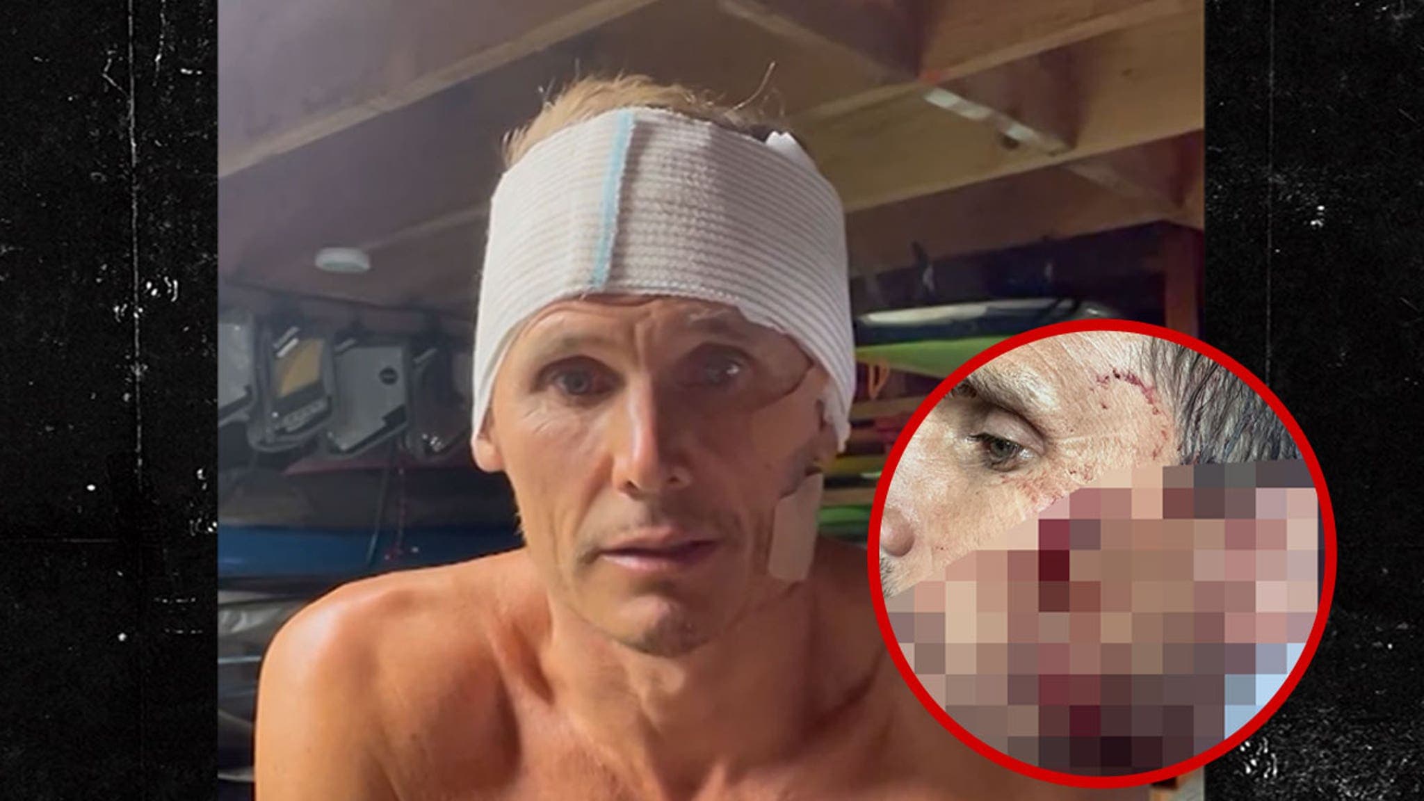Surfer’s Wipeout: When Riding Waves Turns into a Bloody Nightmare