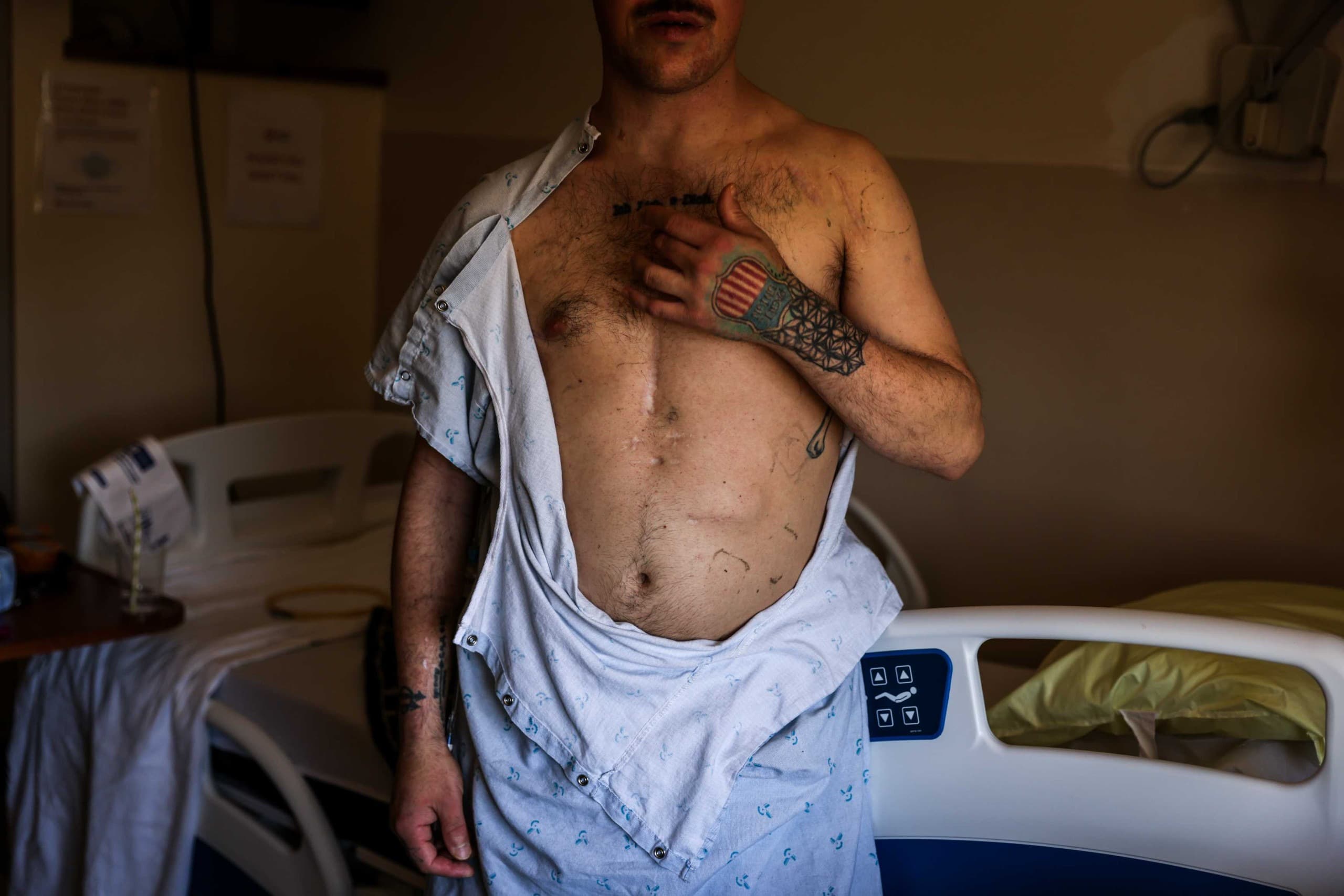Heart Infections and Addiction: A Survivor’s Journey Through the Darkness