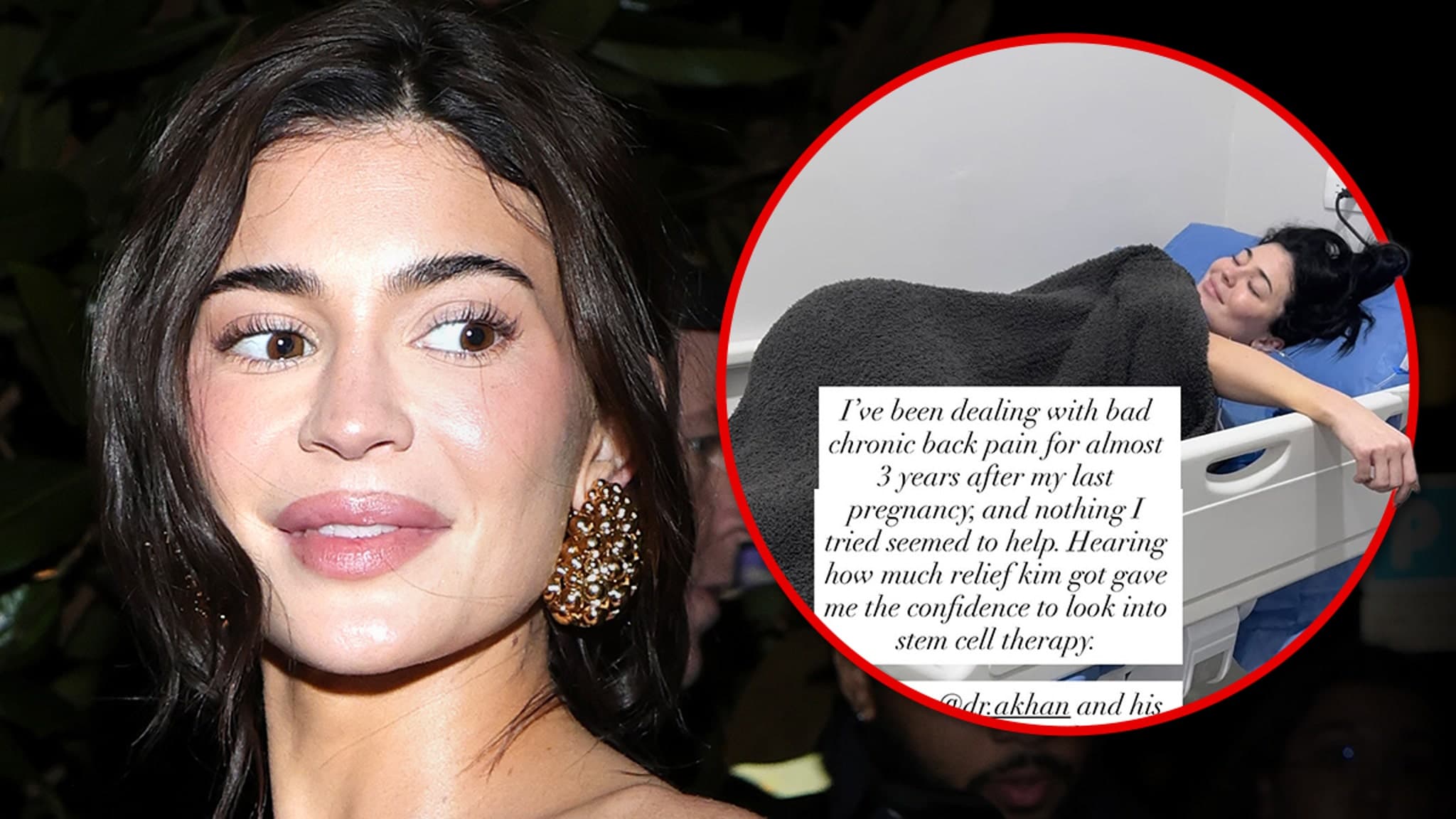 Kylie Jenner's Pain Relief Journey: From Chronic Back Pain to Stem Cell Therapy Success